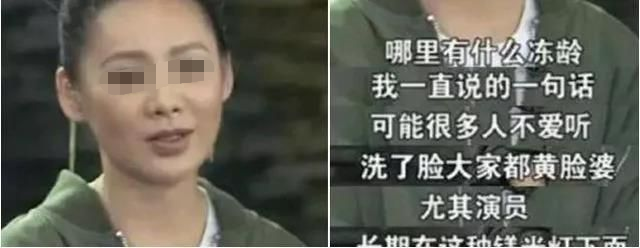 面部提升术