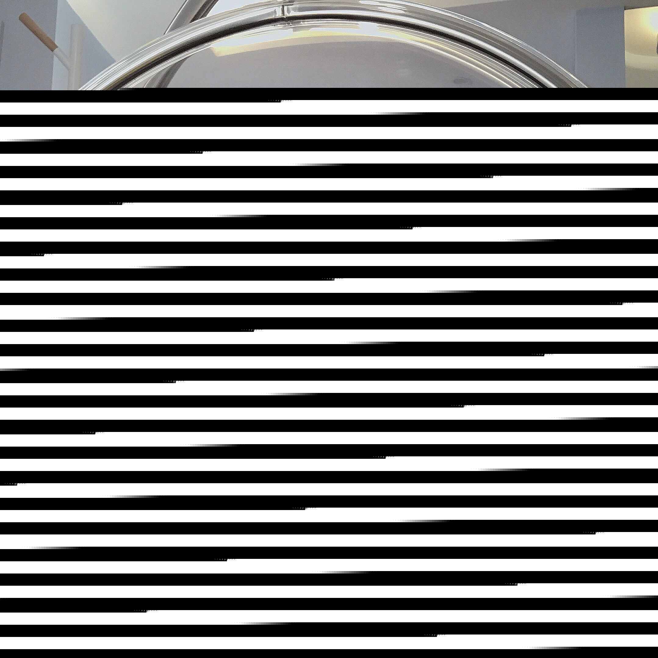 双眼皮手术