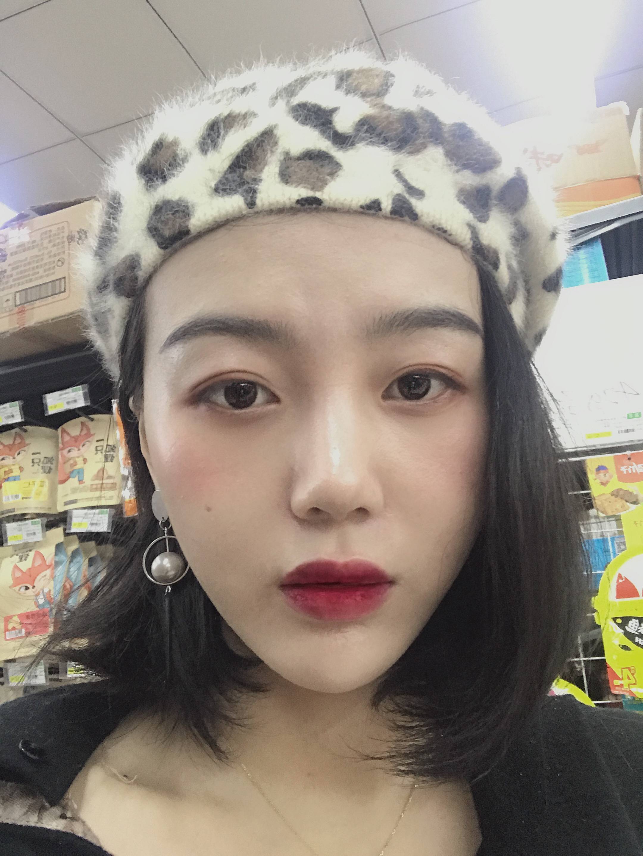 双眼皮手术
