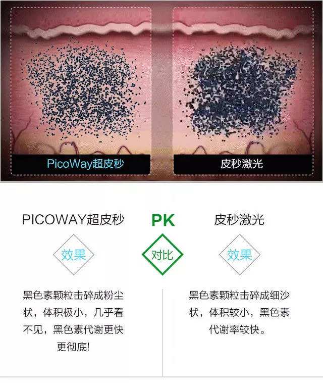 超皮秒祛斑