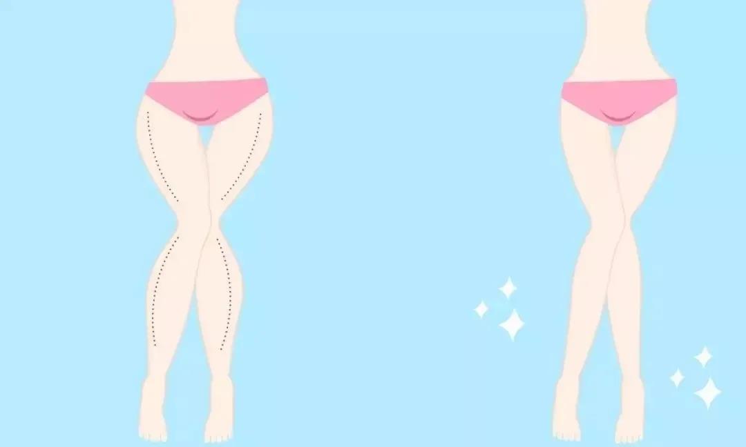 超声波减肥