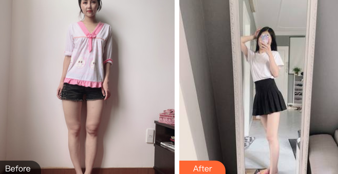 超声波减肥