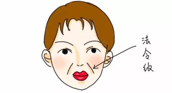 面部提升术