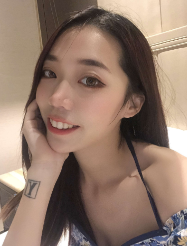 面部提升术