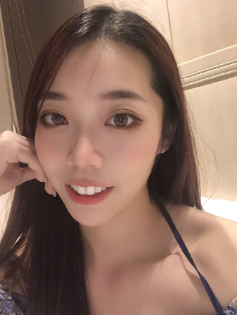 面部提升术