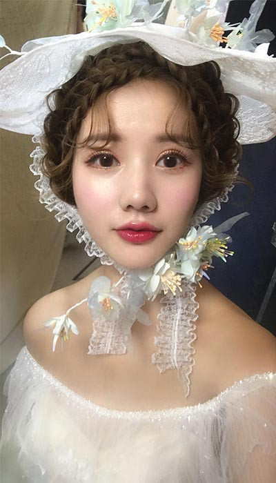 双眼皮手术
