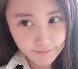 去眼袋手术