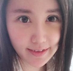 去眼袋手术