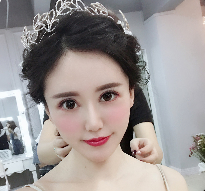 去眼袋手术
