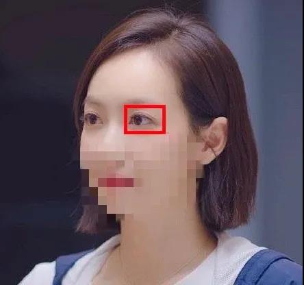 长效玻尿酸