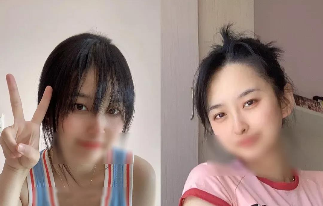 长效玻尿酸