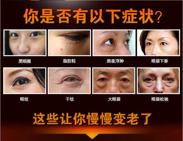 去眼袋手术