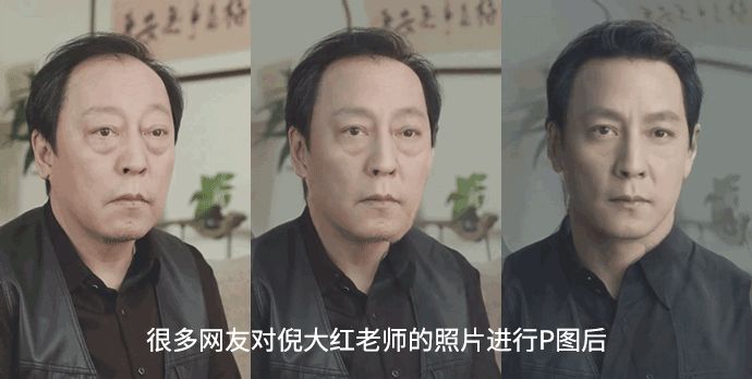 去眼袋手术