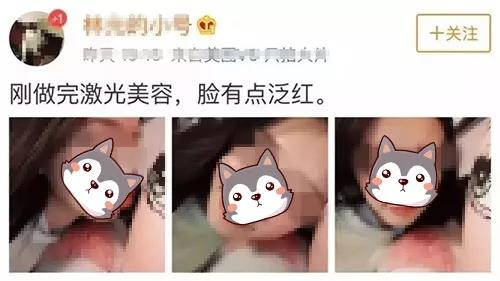 超皮秒祛斑