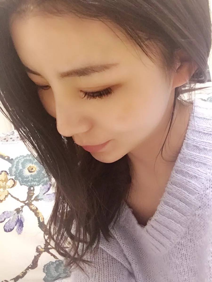 不开刀隆鼻