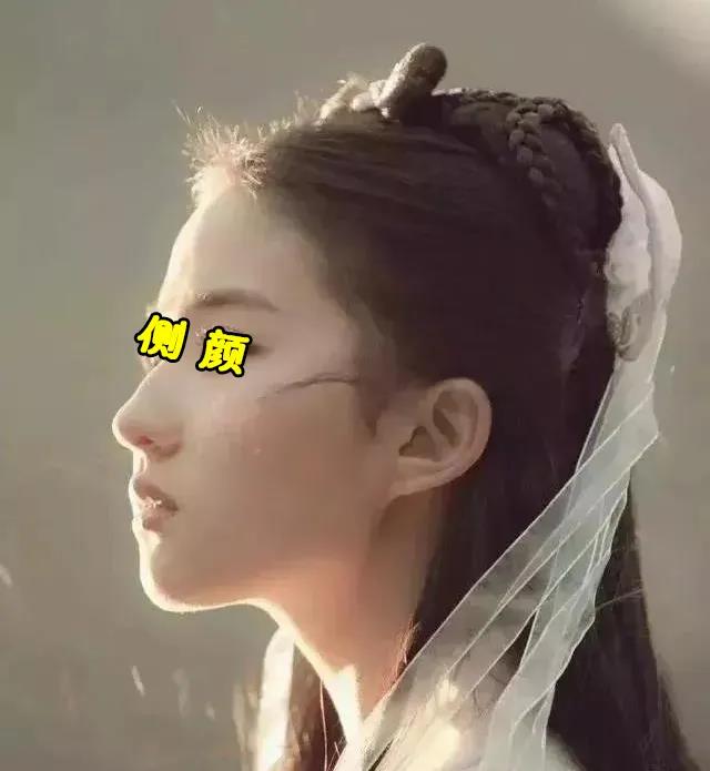 不开刀隆鼻