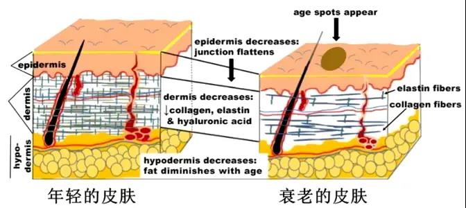 面部提升术
