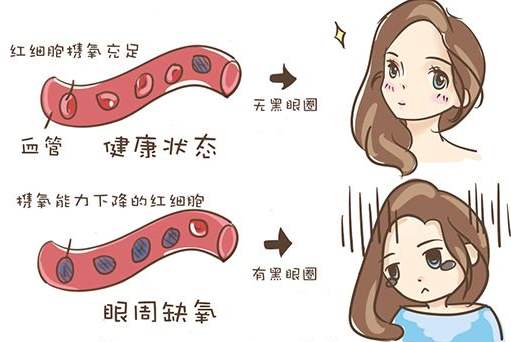 去眼袋手术