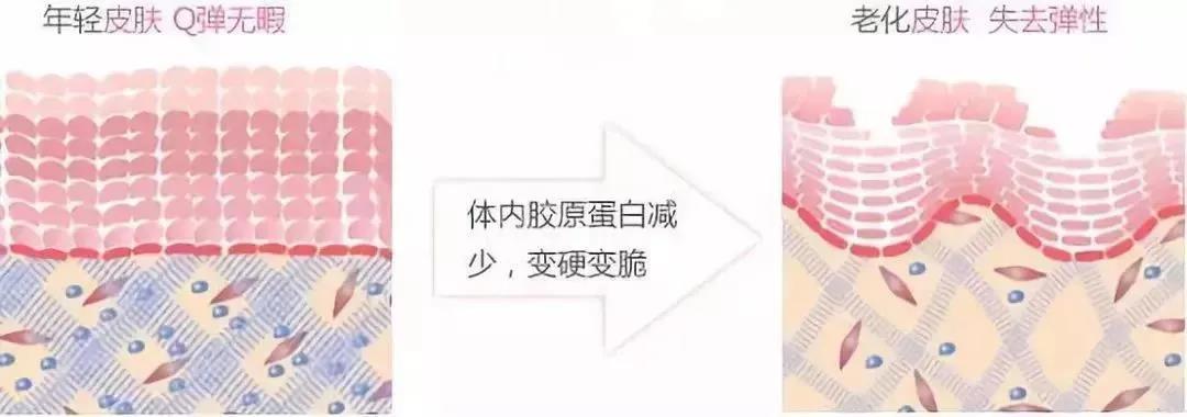 去眼袋手术