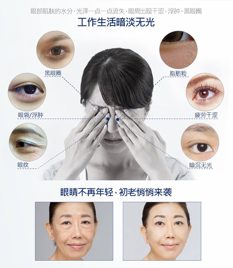 去眼袋手术
