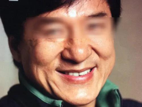 隆鼻手术
