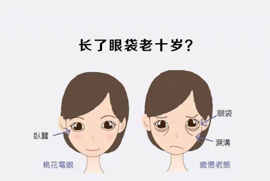 去眼袋手术