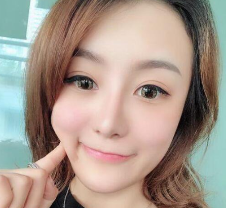 自体脂肪填充术