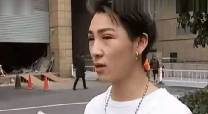 双眼皮手术