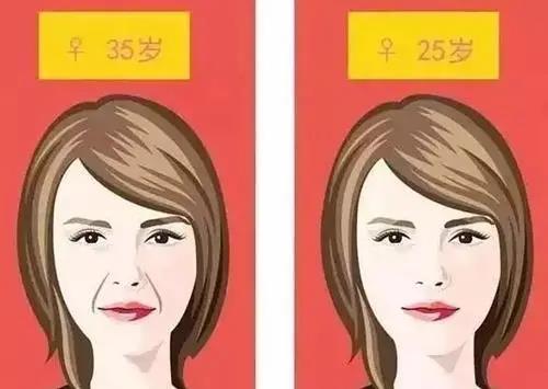 面部提升术