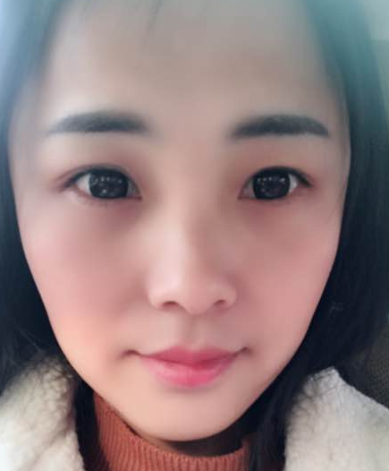 去眼袋手术