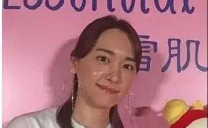 面部提升术
