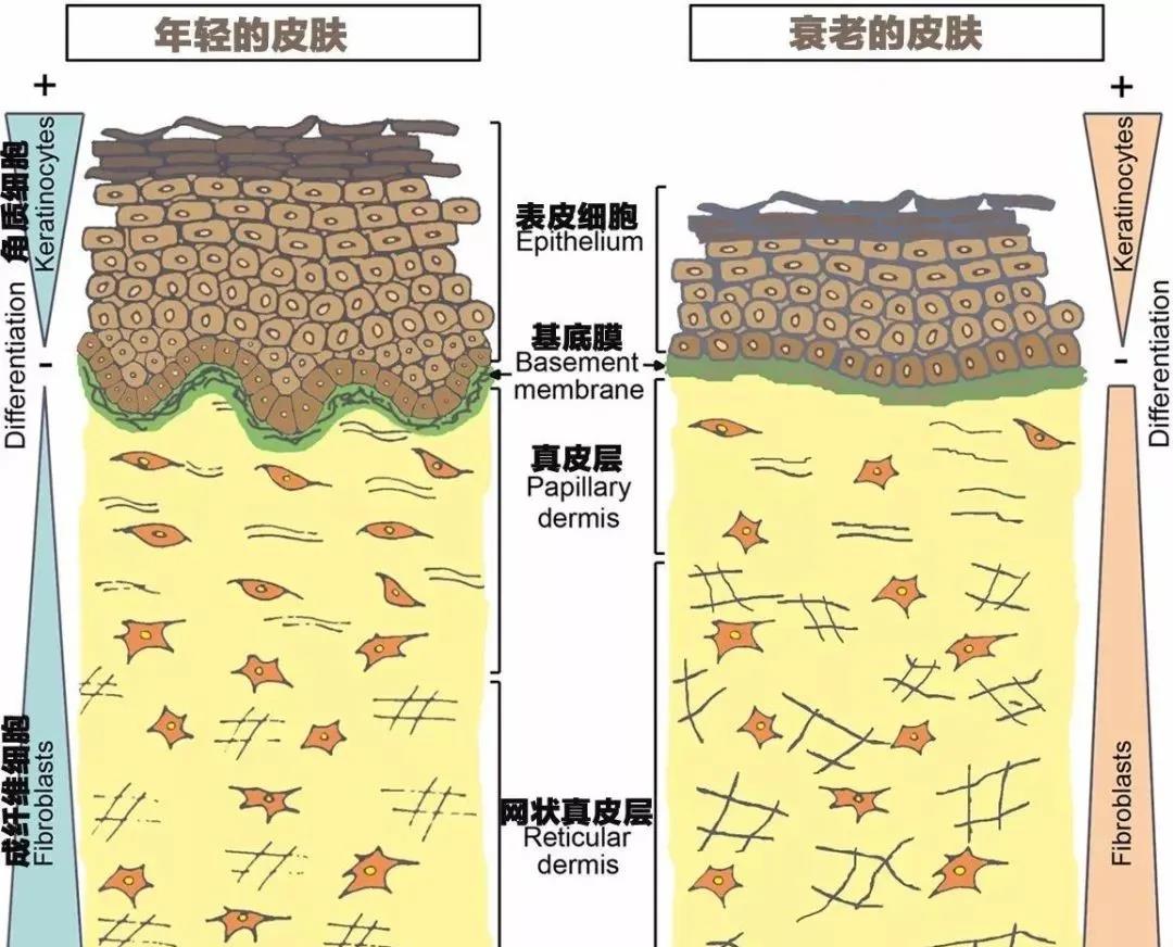 面部提升术