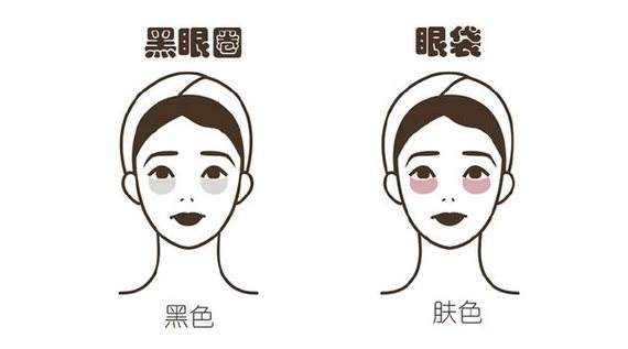 去眼袋手术