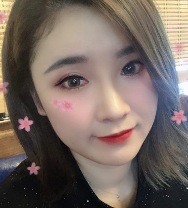 双眼皮手术