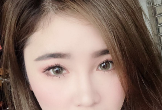 双眼皮手术