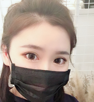 双眼皮手术