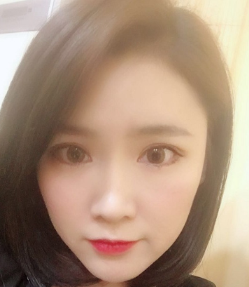 双眼皮手术