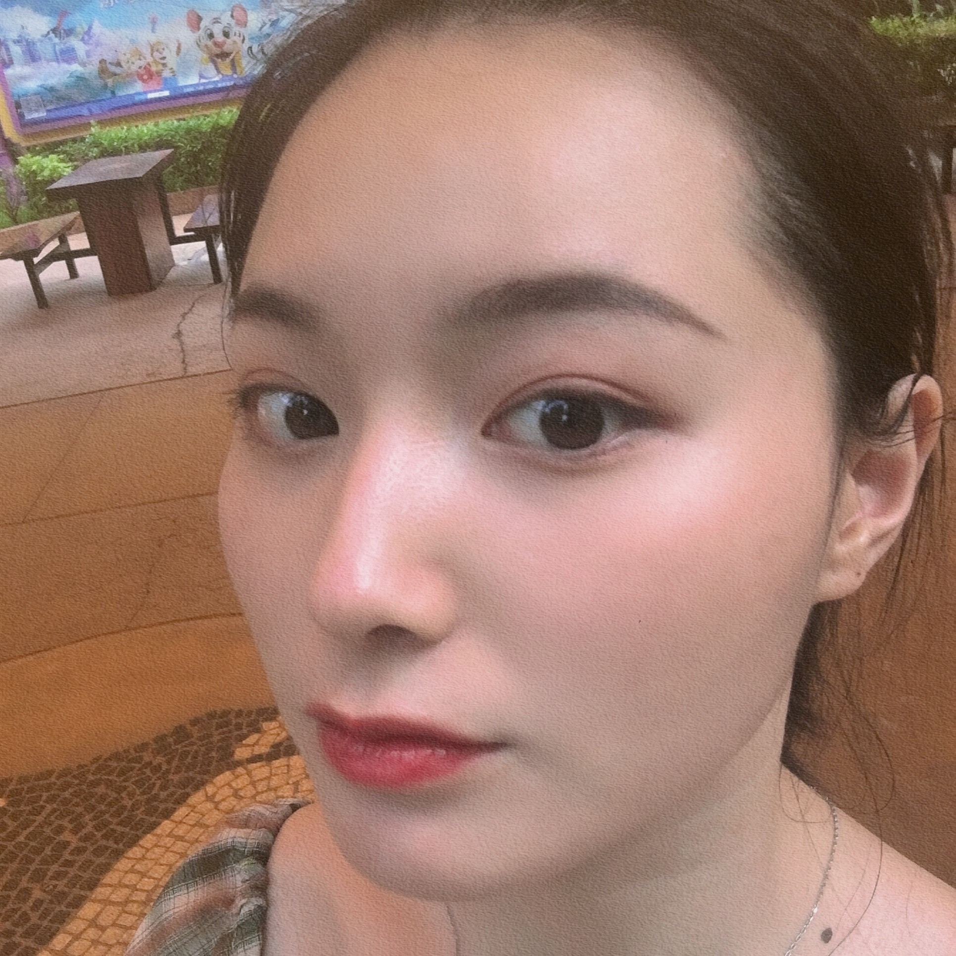 超皮秒祛斑
