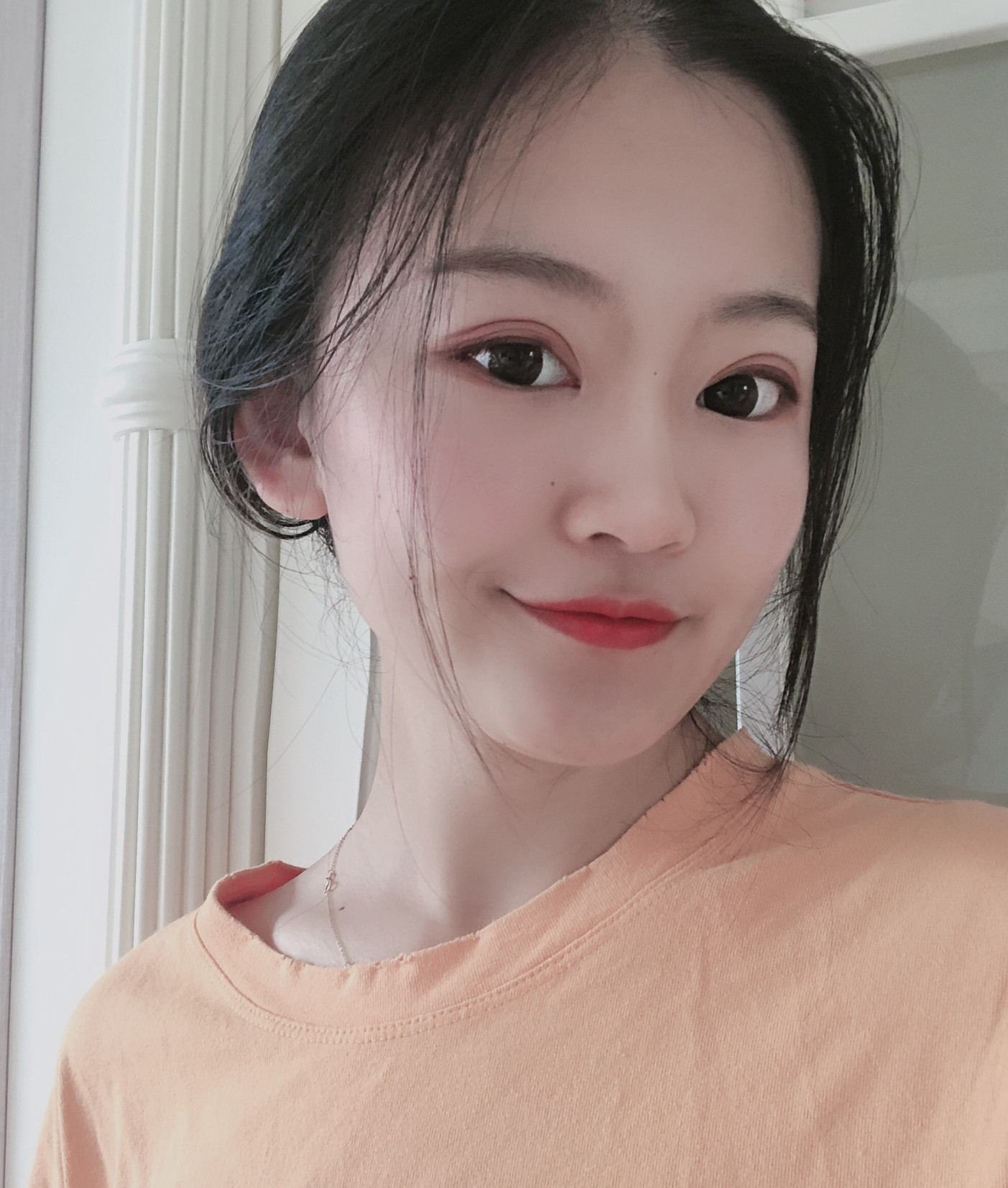 双眼皮手术