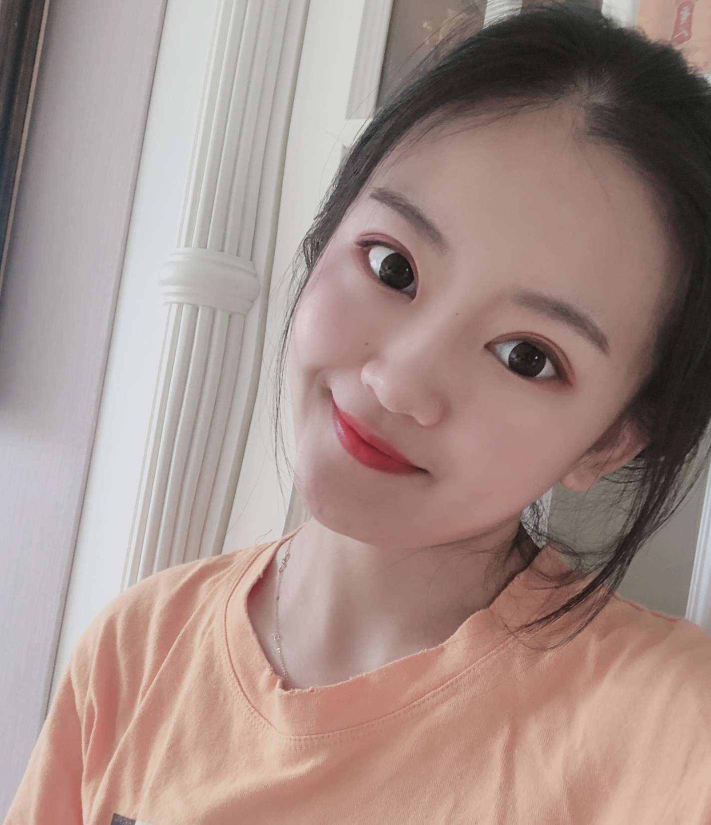 双眼皮手术