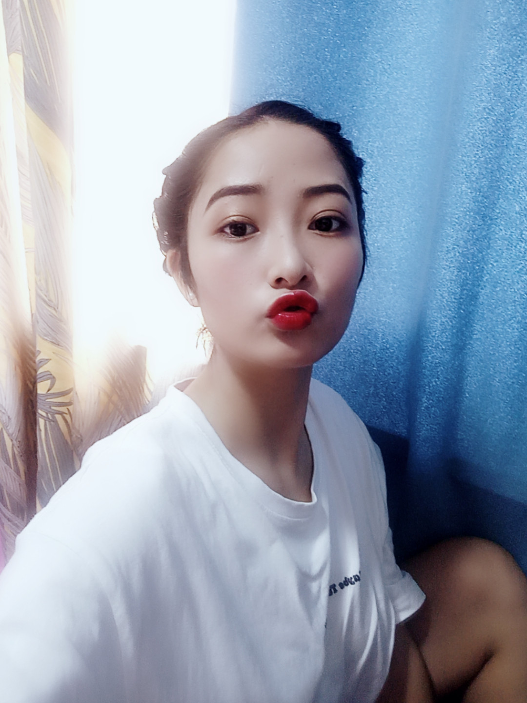 长效玻尿酸
