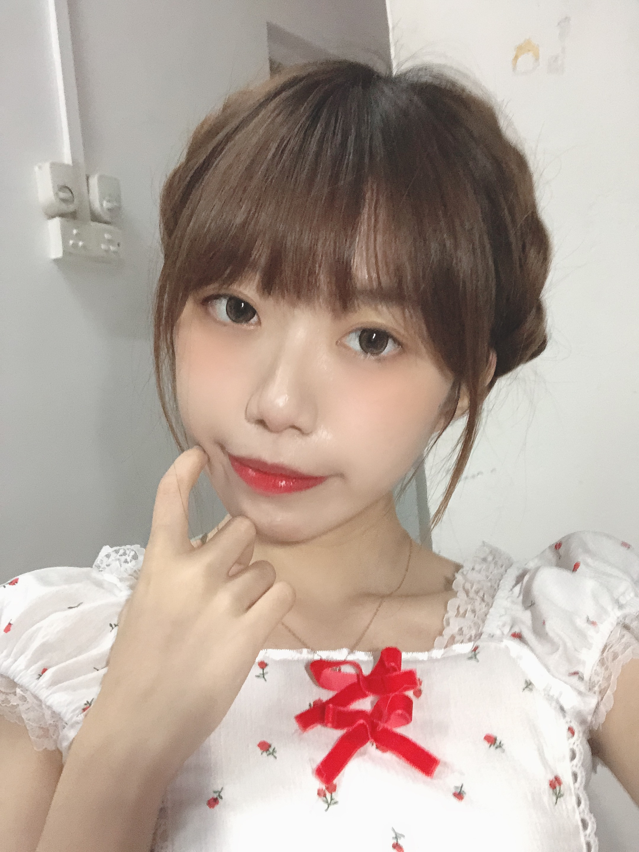 双眼皮手术