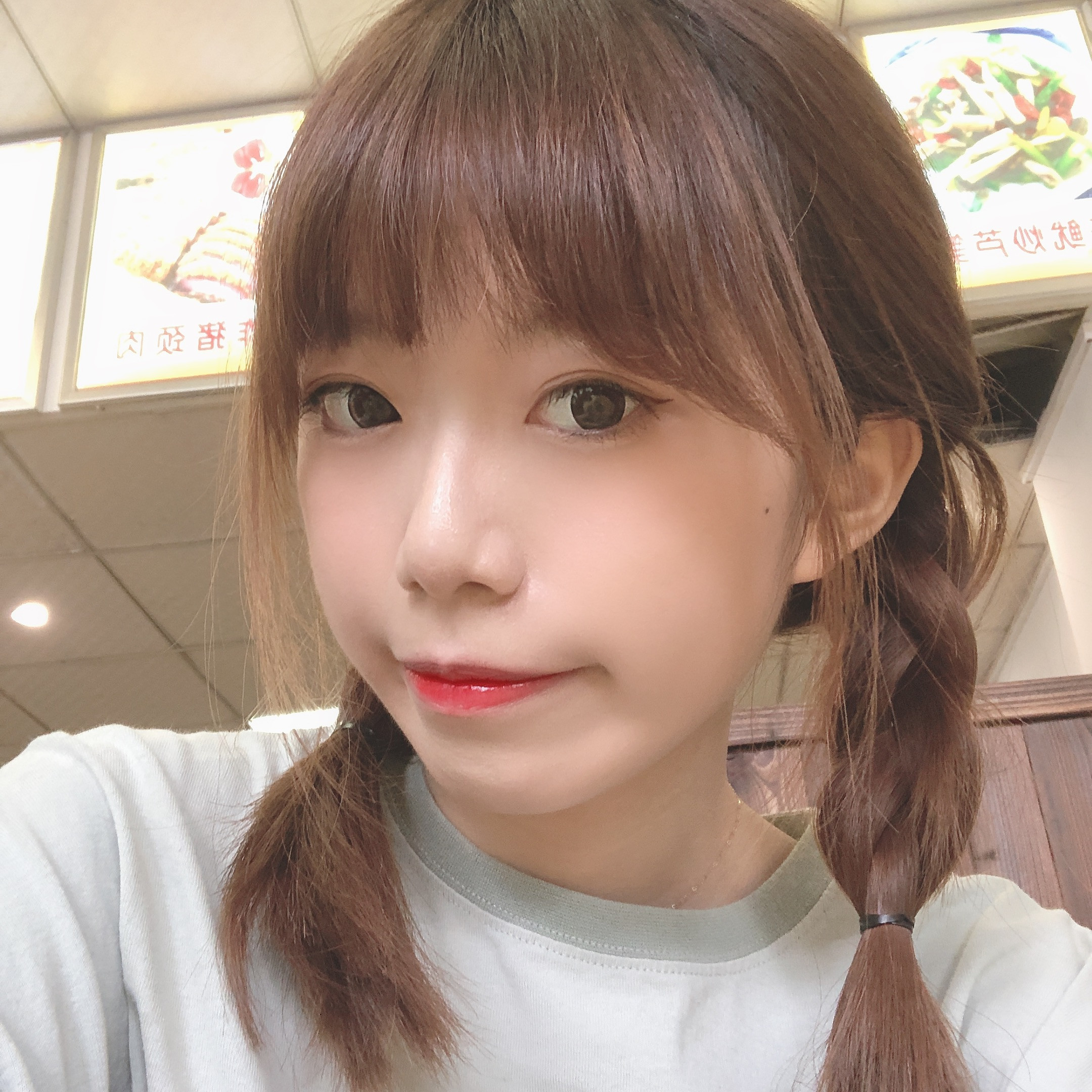双眼皮手术