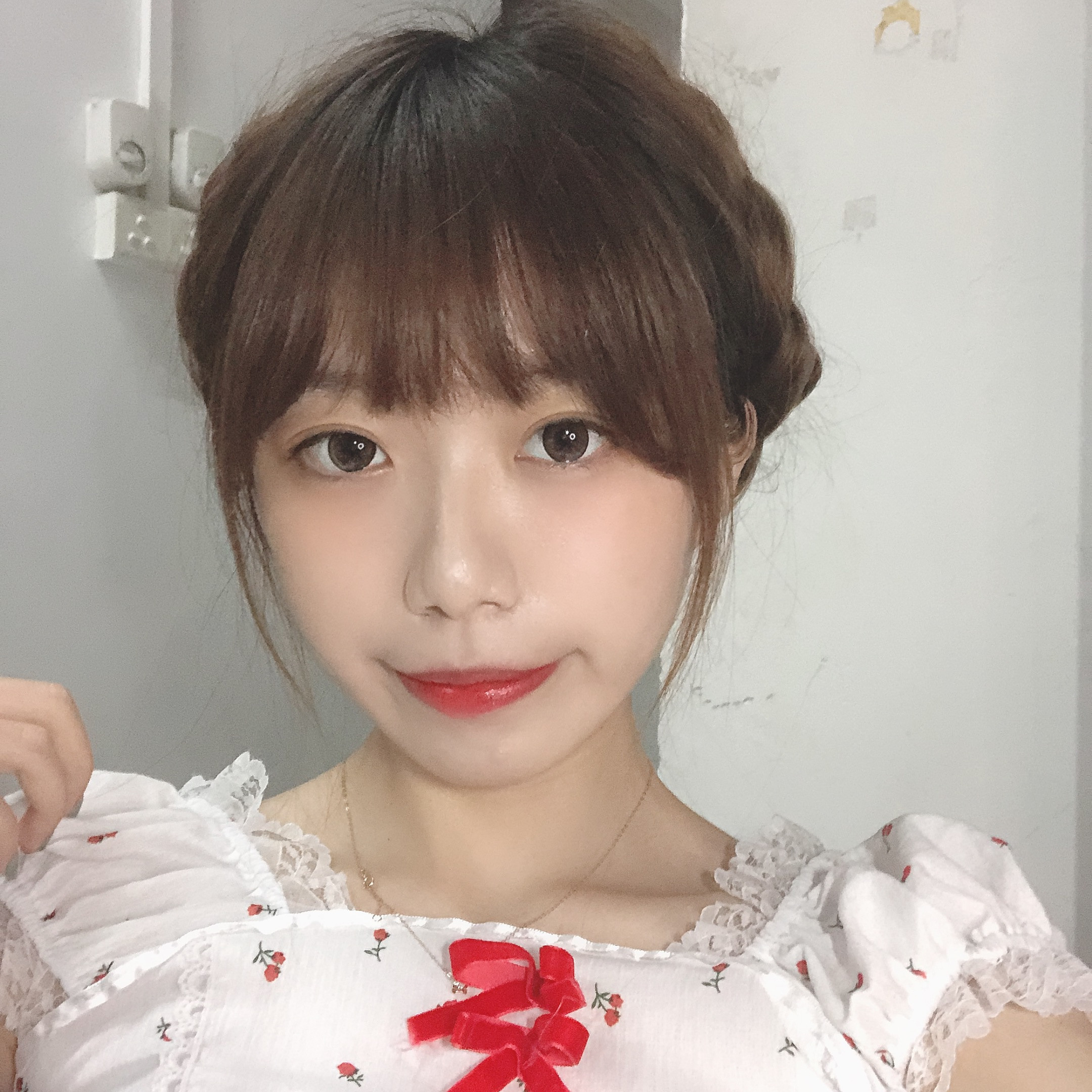 双眼皮手术