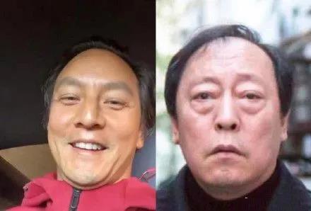 去眼袋手术