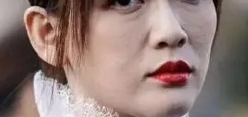 面部提升术