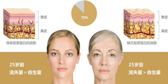 面部提升术