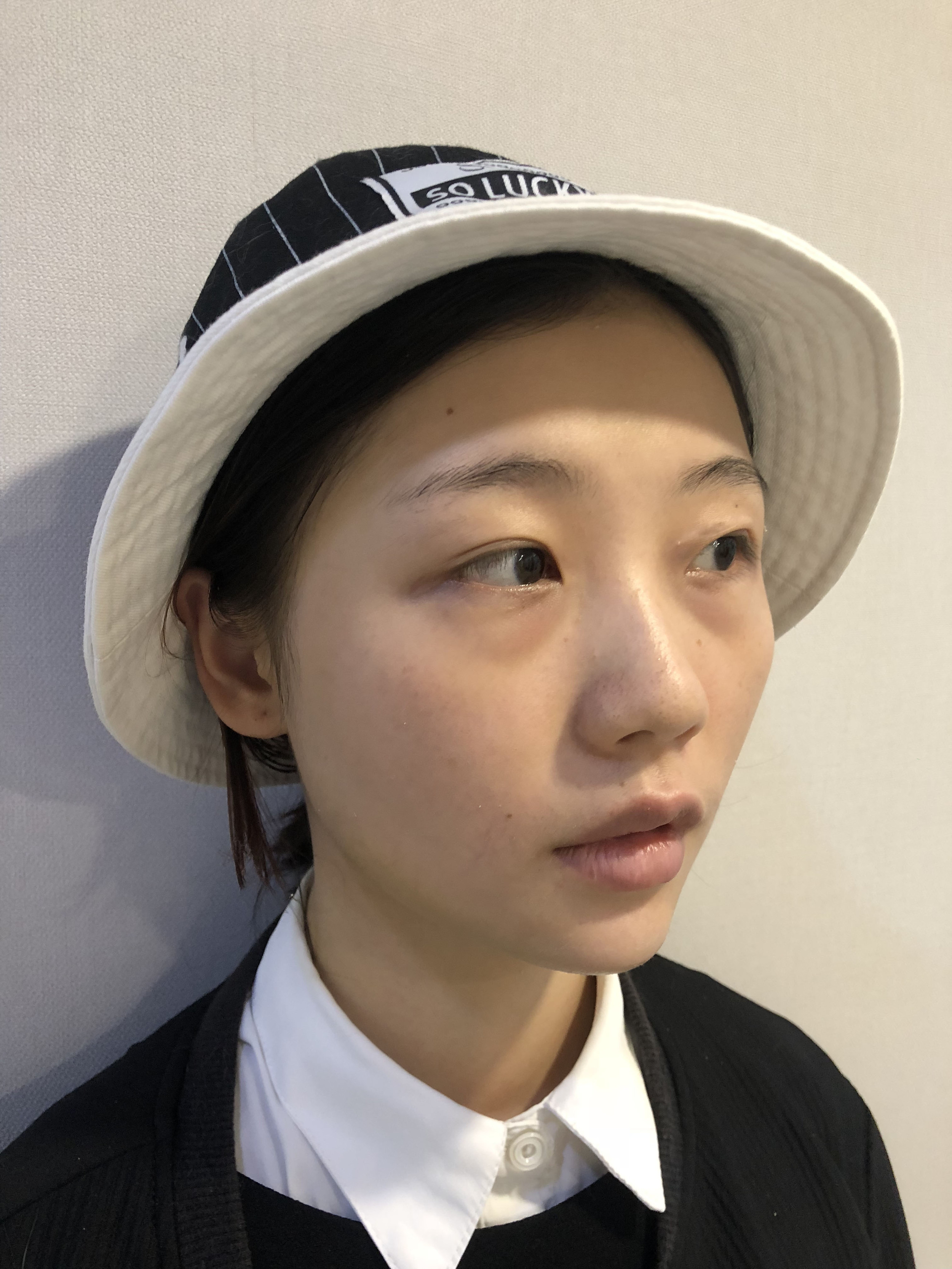 长效玻尿酸