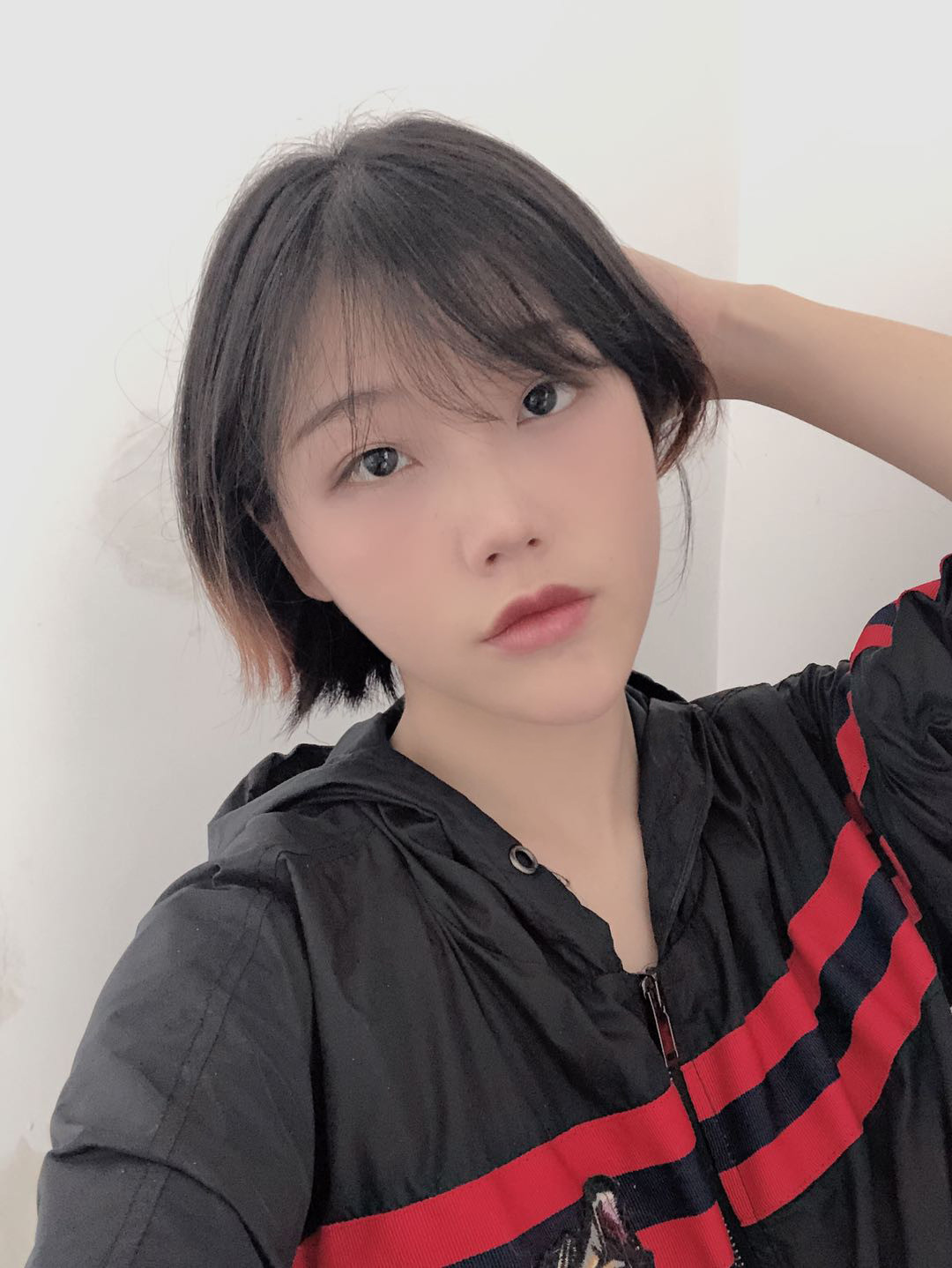 长效玻尿酸