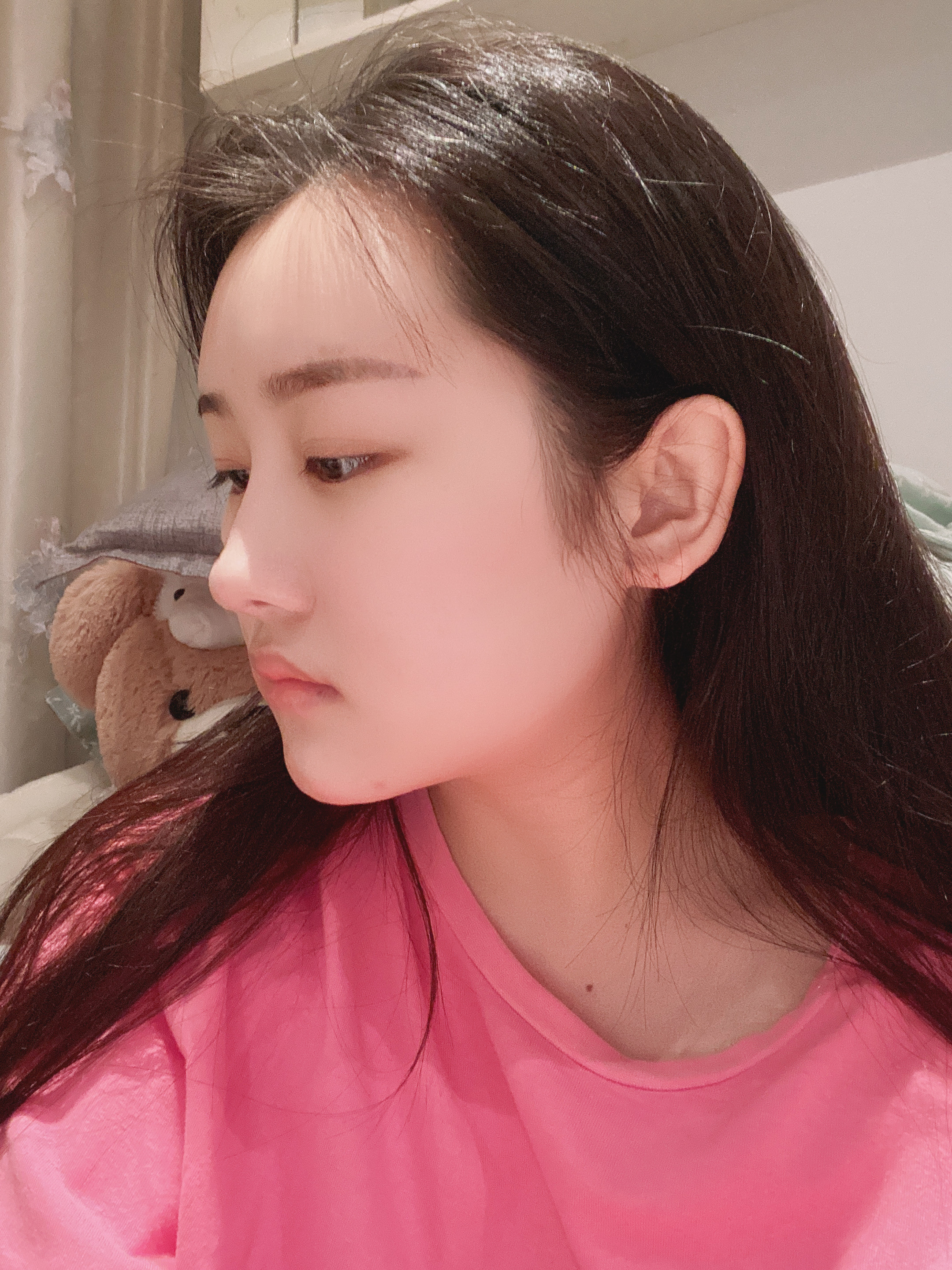 长效玻尿酸